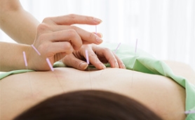 Can Acupuncture Treat Chronic Back Pain?