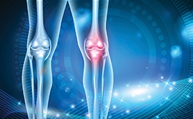 Understanding PRP Therapy for Arthritis