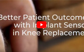 Better Patient Outcomes with Implant Sensors in Knee Replacement