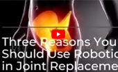 Three Reasons Your Surgeon Should Use Robotics in Joint Replacement